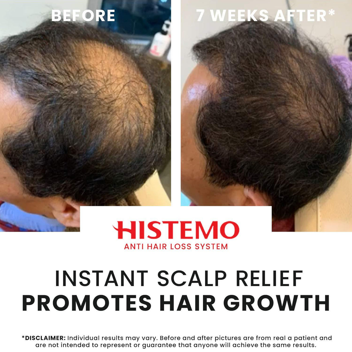 Before and after 7 weeks with ION-TO T Forte